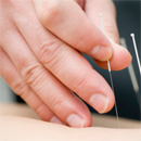 Acupuncture Health Benefits and ...