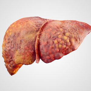 Liver failure treatment using immune system improvements