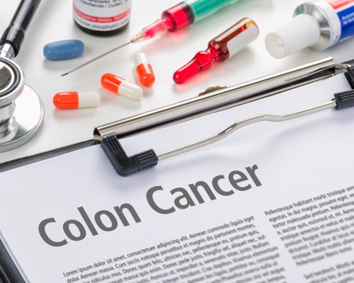 1 in 7 colon cancer patients diagnosed prior to screening age