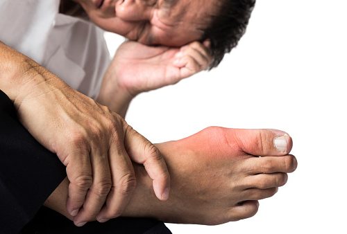 Gout Increase Type 2 Diabetes Risk Women More Vulnerable Then Men