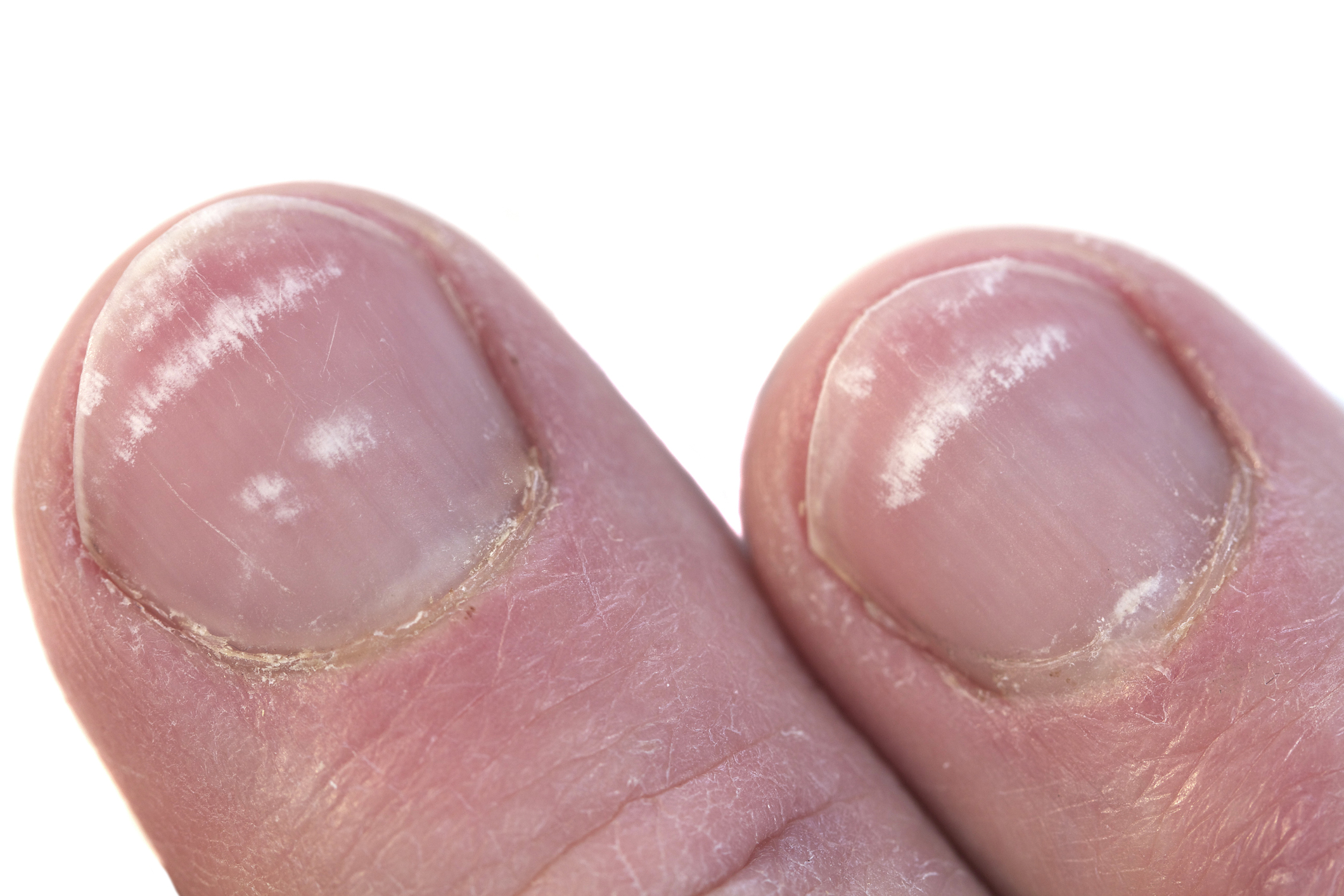 Find Out What to Eat to Increase Overall Health and General Well-Being of  Your Nails