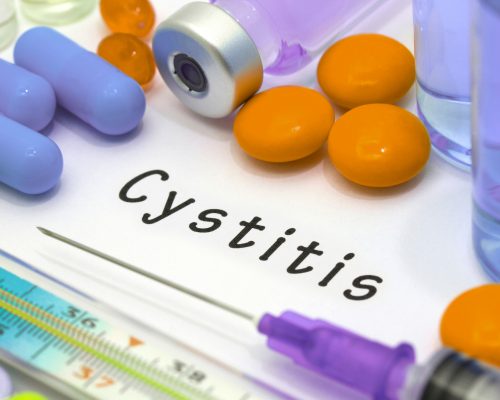 Interstitial cystitis: Causes, symptoms, and treatment