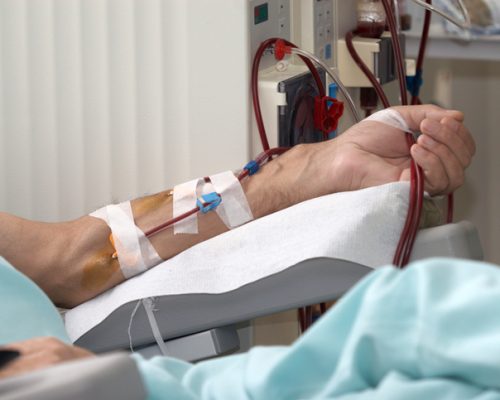 CDC focuses on improving safety during dialysis