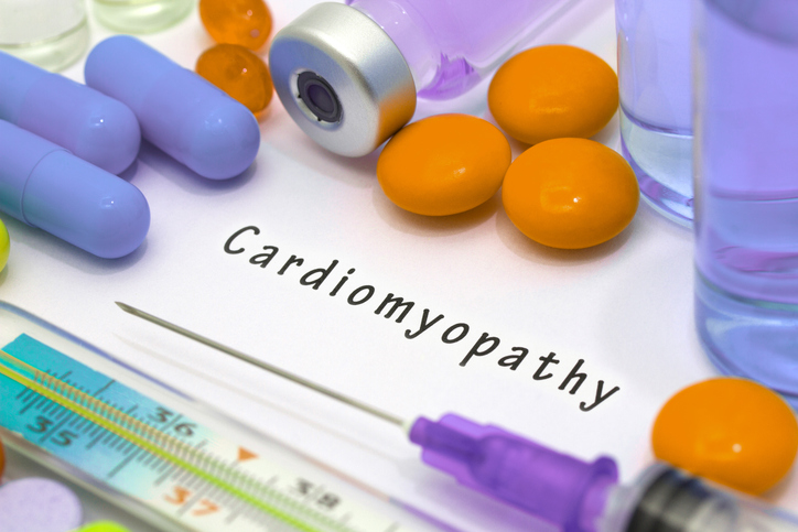 Restrictive cardiomyopathy in ol...