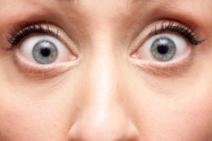 medical term for bulging eyeballs