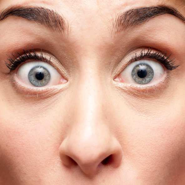 Bulging Eyes Causes Exercises And Safety Tips