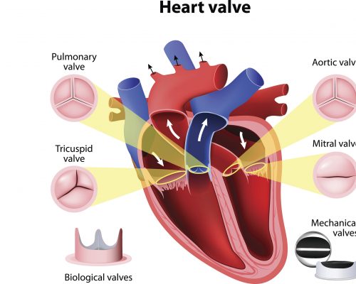 heart-valve-disease-causes-risks-and-symptoms