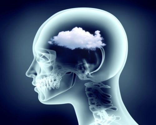 tms brain fog symptoms