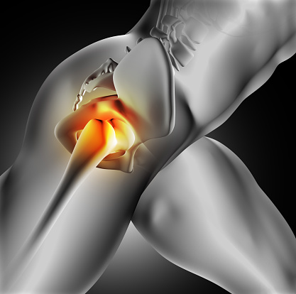 Iliac crest pain: Causes, home remedies, and exercises