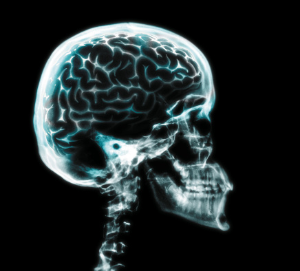 What causes thalamic stroke? Sym...