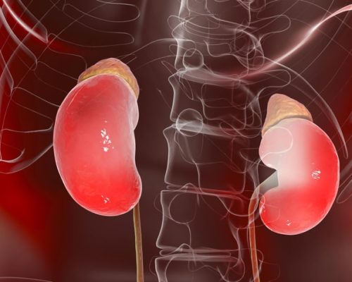 Rheumatoid arthritis and kidneys