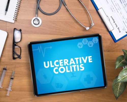 Ulcerative Colitis Linked with Joint Pain