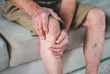 High Prevalence of Arthritis Sym...