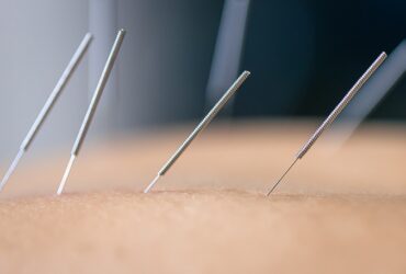 Study Finds Acupuncture Effectiv...